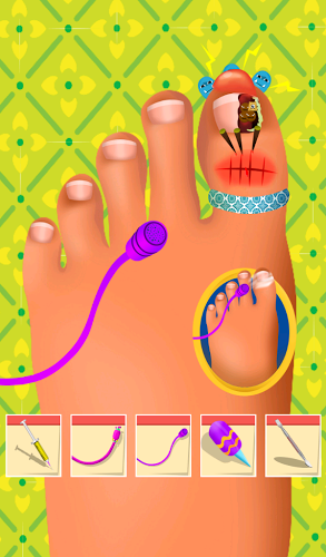 Feet Hospital Operating Games截图3