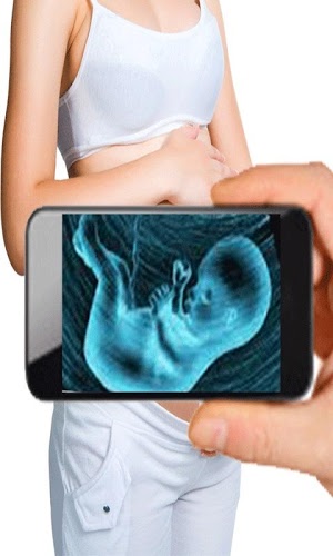 Ultrasound Scanner (Prank)截图4