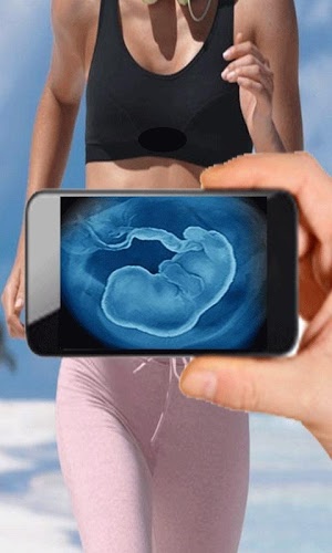 Ultrasound Scanner (Prank)截图3