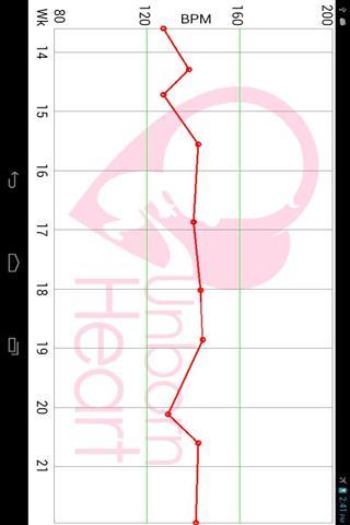 胎儿多普勒 UnbornHeart截图2