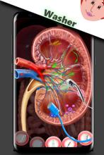 Kidney Surgery - Last Treatment 2020截图2