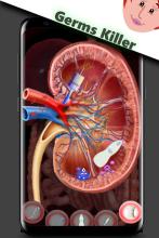 Kidney Surgery - Last Treatment 2020截图3