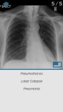 Plain Films - Radiology for Medical Students截图2