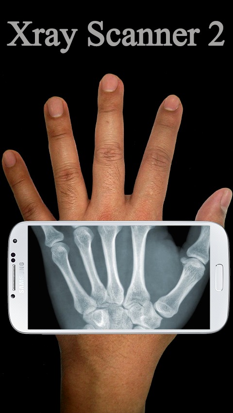 Xray Scanner Prank 2截图2