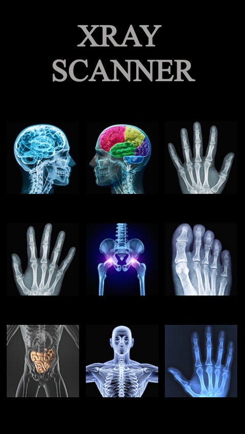 Xray Scanner Prank 2截图1