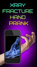 Xray Fracture Hand Prank截图1
