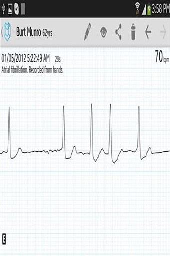 心脏监视器截图4