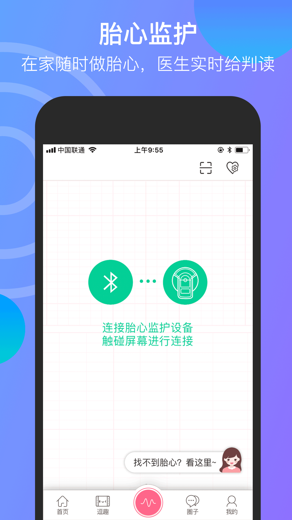 微胎心v2.4.3截图4