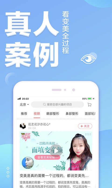 悦美微整形v6.8.6截图3