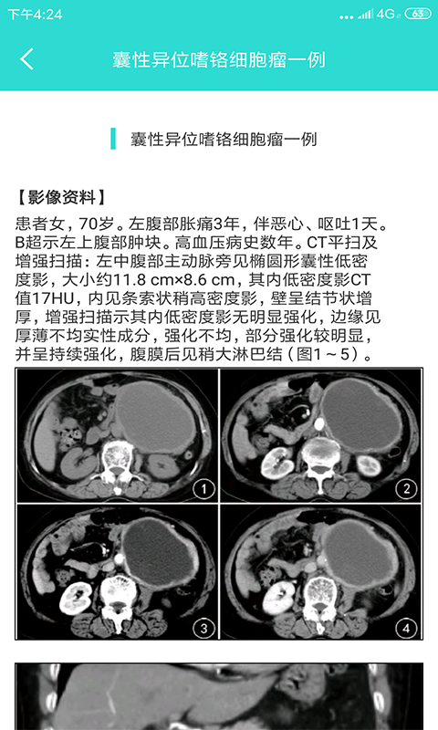 影像图鉴v1.1.0截图4