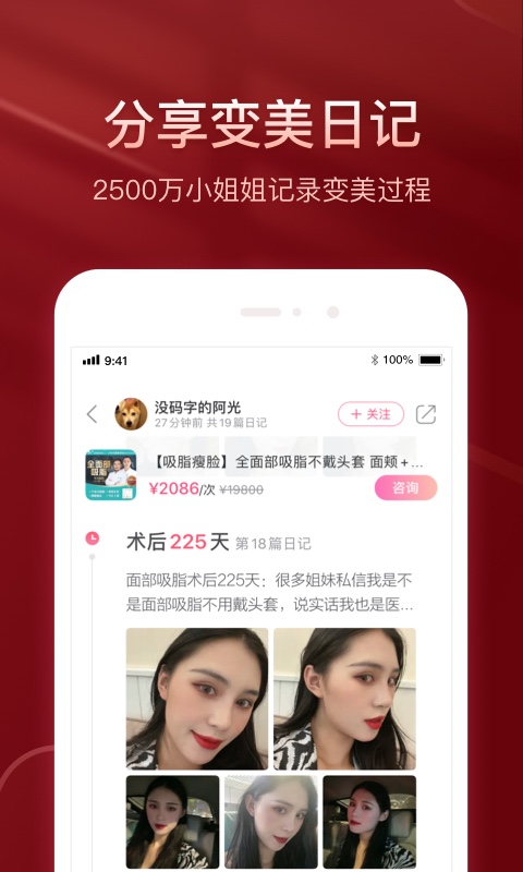 悦美微整形v7.6.0截图4