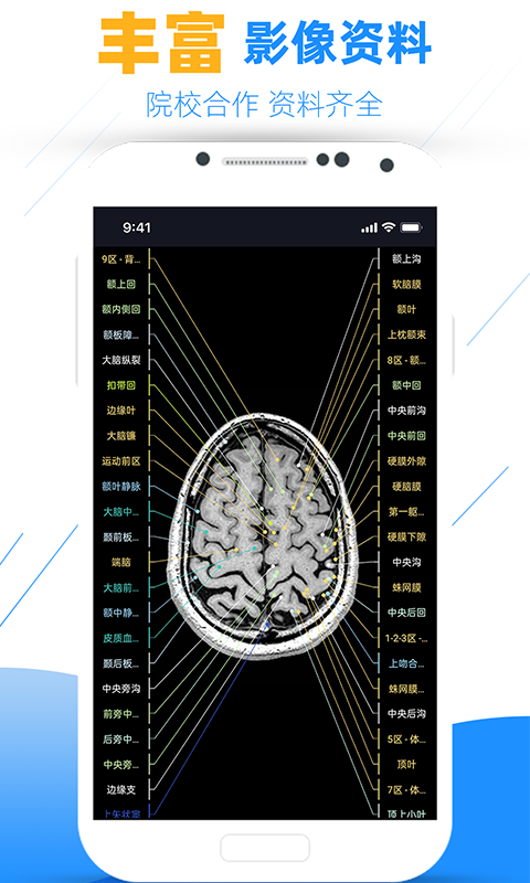 影像学图谱v200截图2