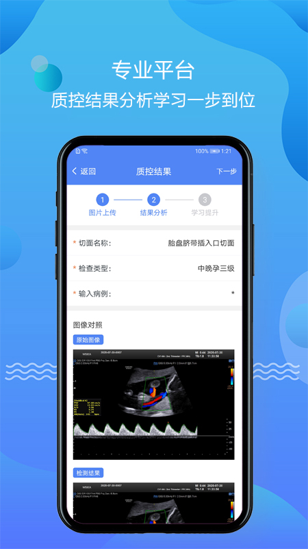 超声智库截图2