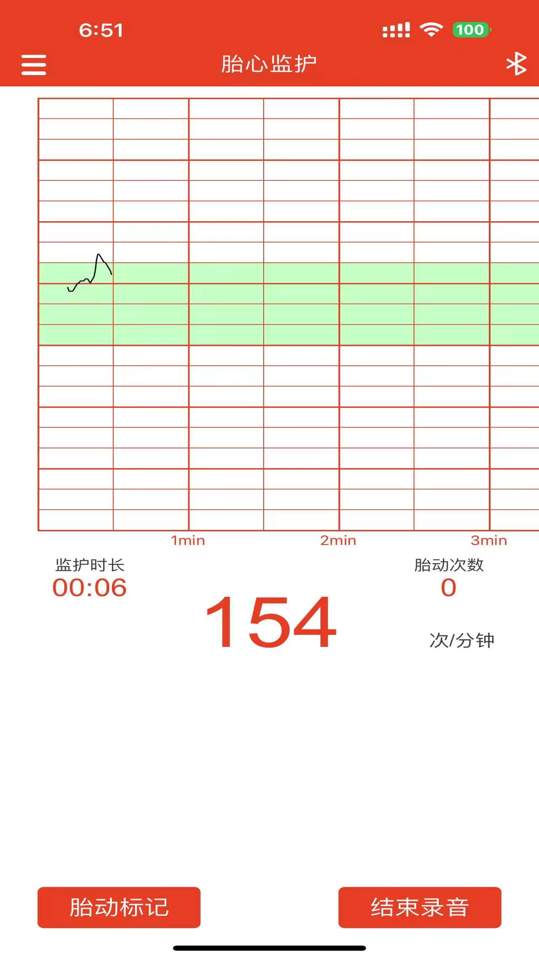 左点胎心仪vV1.0截图3