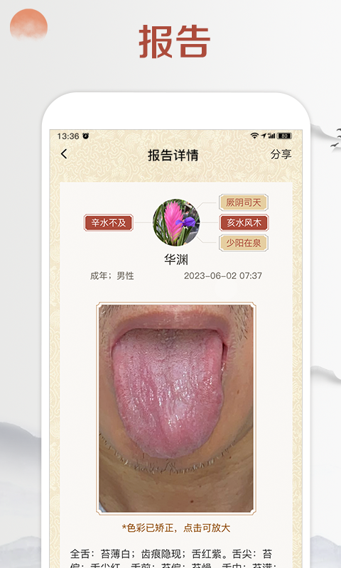 看舌头v3.3.12截图1