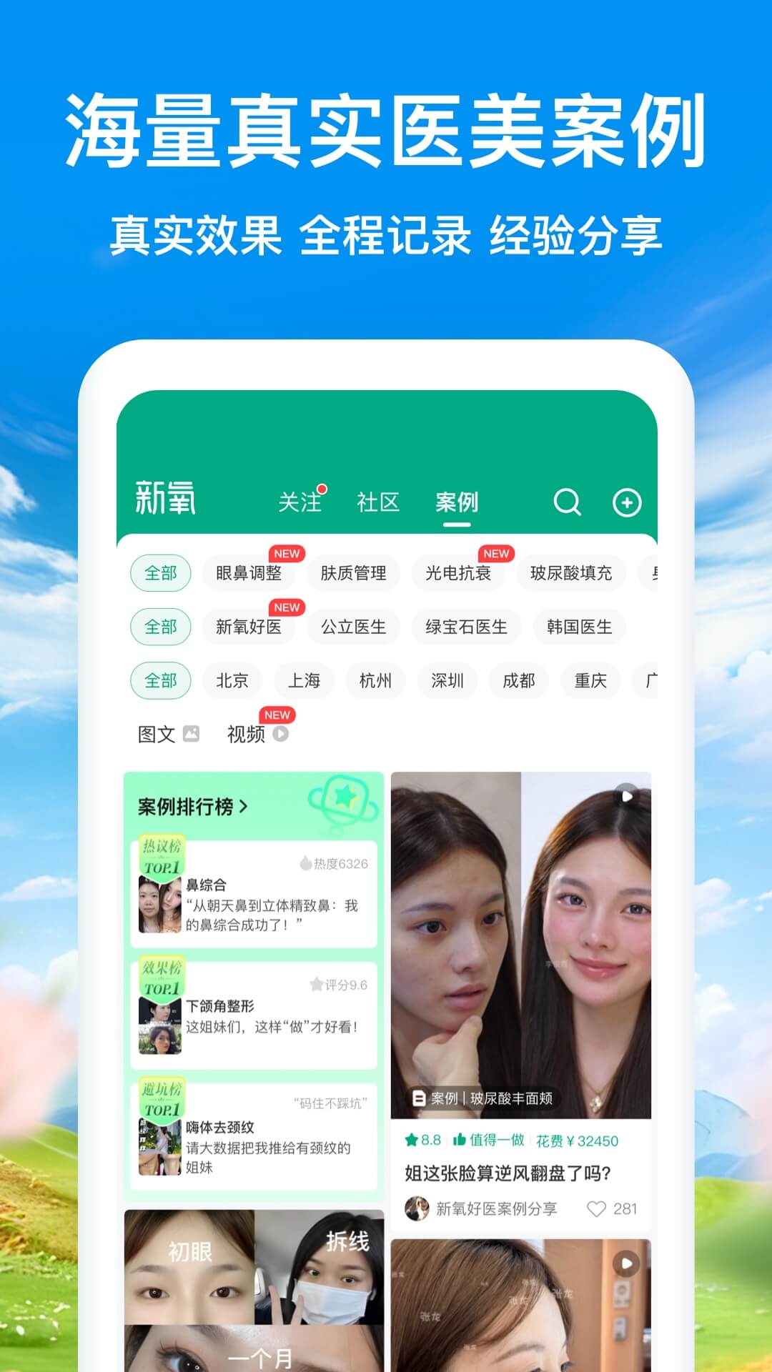 新氧极速版截图4