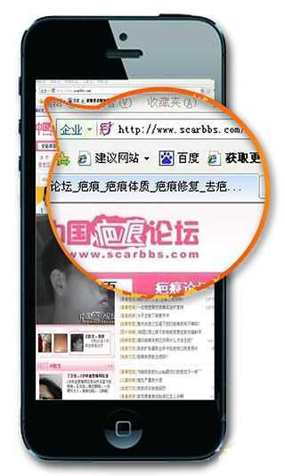 中国疤痕论坛截图1