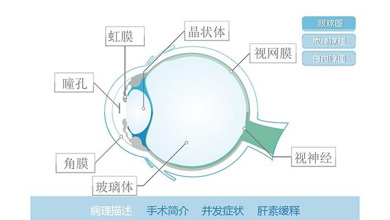 白内障点点通截图2