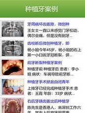 牙齿种植专家截图4